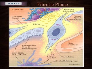 Fibrotic Phase
 
