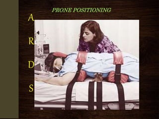 PRONE POSITIONING
A
R
D
S
 