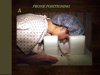 PRONE POSITIONING
A
R
D
S
 