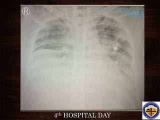 4th HOSPITAL DAY
 