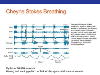 Cheyne Stokes Breathing 
Cycles of 60-120 seconds 
Waxing and waning pattern w/ lack of rib cage or abdomen movement 
 