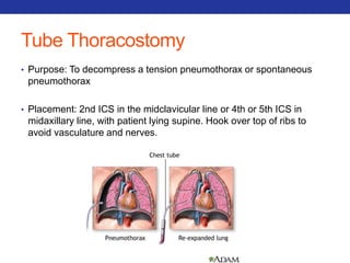 Tube Thoracostomy 
• Purpose: To decompress a tension pneumothorax or spontaneous 
pneumothorax 
• Placement: 2nd ICS in the midclavicular line or 4th or 5th ICS in 
midaxillary line, with patient lying supine. Hook over top of ribs to 
avoid vasculature and nerves. 
 