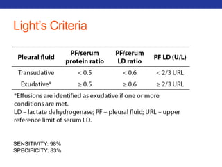 Light’s Criteria 
SENSITIVITY: 98% 
SPECIFICITY: 83% 
 