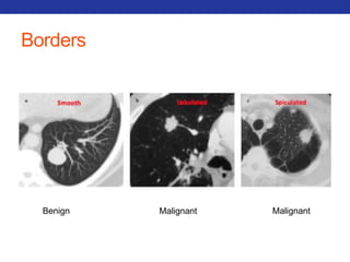 Borders 
Benign Malignant Malignant 
 
