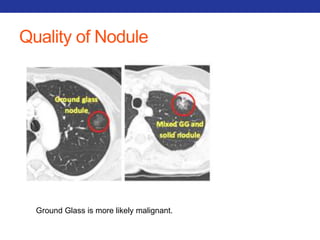 Quality of Nodule 
Ground Glass is more likely malignant. 
 