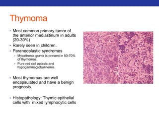 Thymoma 
• Most common primary tumor of 
the anterior mediastinum in adults 
(20-30%) 
• Rarely seen in children. 
• Paraneoplastic syndromes 
• Myasthenia gravis is present in 50-70% 
of thymomas. 
• Pure red cell aplasia and 
hypogammaglobulinemia. 
• Most thymomas are well 
encapsulated and have a benign 
prognosis. 
• Histopathology: Thymic epithelial 
cells with mixed lymphocytic cells 
 