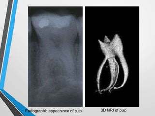 Pulp | PPTX