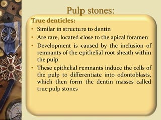 Pulp stones:
True denticles:
• Similar in structure to dentin
• Are rare, located close to the apical foramen
• Development is caused by the inclusion of
remnants of the epithelial root sheath within
the pulp
• These epithelial remnants induce the cells of
the pulp to differentiate into odontoblasts,
which then form the dentin masses called
true pulp stones
 