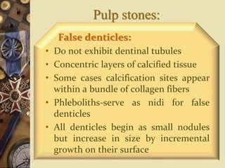 Pulp stones:
False denticles:
• Do not exhibit dentinal tubules
• Concentric layers of calcified tissue
• Some cases calcification sites appear
within a bundle of collagen fibers
• Phleboliths-serve as nidi for false
denticles
• All denticles begin as small nodules
but increase in size by incremental
growth on their surface
 