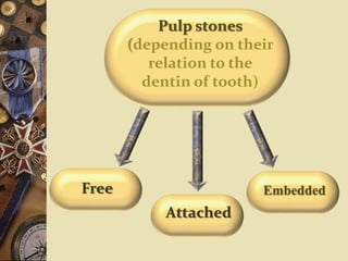 Pulp stones
(depending on their
relation to the
dentin of tooth)
Free
Attached
Embedded
 
