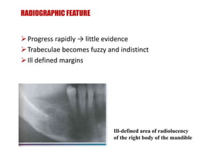 pulp-and-periapical-lesions-of-the-tooth-ppt.pdf