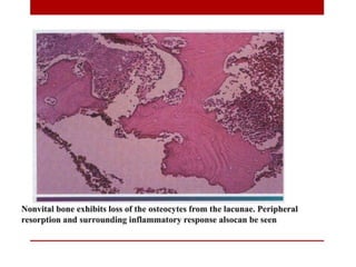 pulp-and-periapical-lesions-of-the-tooth-ppt.pdf