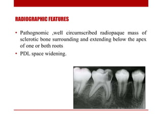 pulp-and-periapical-lesions-of-the-tooth-ppt.pdf