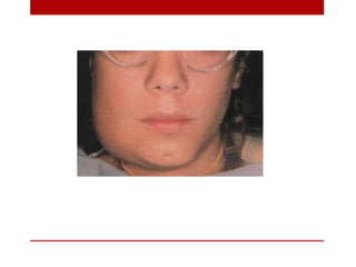 pulp-and-periapical-lesions-of-the-tooth-ppt.pdf