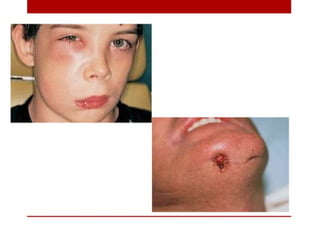 pulp-and-periapical-lesions-of-the-tooth-ppt.pdf