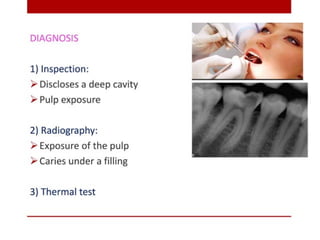 pulp-and-periapical-lesions-of-the-tooth-ppt.pdf