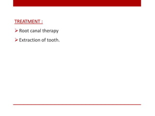 pulp-and-periapical-lesions-of-the-tooth-ppt.pdf