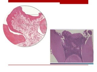 pulp-and-periapical-lesions-of-the-tooth-ppt.pdf