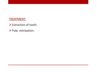 pulp-and-periapical-lesions-of-the-tooth-ppt.pdf