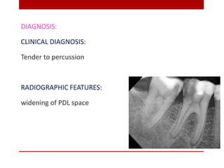 pulp-and-periapical-lesions-of-the-tooth-ppt.pdf