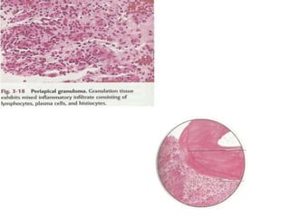 pulp-and-periapical-lesions-of-the-tooth-ppt.pdf