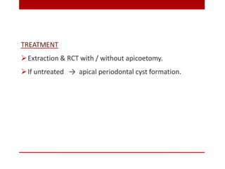 pulp-and-periapical-lesions-of-the-tooth-ppt.pdf