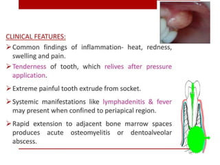 pulp-and-periapical-lesions-of-the-tooth-ppt.pdf