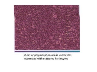 pulp-and-periapical-lesions-of-the-tooth-ppt.pdf