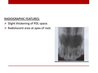 pulp-and-periapical-lesions-of-the-tooth-ppt.pdf