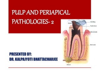 pulp-and-periapical-lesions-of-the-tooth-ppt.pdf