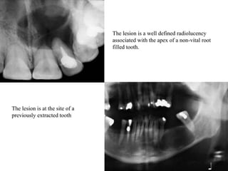 pulp-and-periapical-lesions-of-the-tooth-ppt.pdf