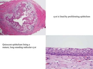 pulp-and-periapical-lesions-of-the-tooth-ppt.pdf