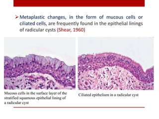 pulp-and-periapical-lesions-of-the-tooth-ppt.pdf