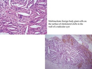 pulp-and-periapical-lesions-of-the-tooth-ppt.pdf