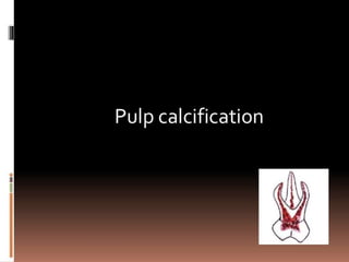 pulp-calcification.pptx