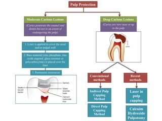Comprehensive Guide to Pulp Protection in Restorative Dentistry | PDF