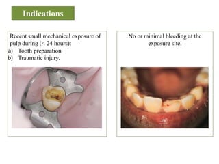Comprehensive Guide to Pulp Protection in Restorative Dentistry | PDF