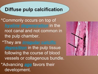 Pulp | PPT