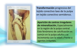 Transformación progresiva del
tejido conectivo laxo de la pulpa
en tejido conectivo semidenso.
Aparición de centros irregulares
de mineralización, Especialmente
en la región de la pulpa central.
Este fenómeno de calcificación es
común en la pulpa adulta y se
incrementa con la edad y frente a
agentes irritantes.
 