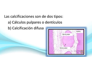 Las calcificaciones son de dos tipos:
a) Cálculos pulpares o dentículos
b) Calcificación difusa
 