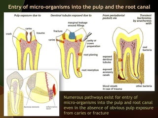 Pulp Extraction Pulp rection to caries and restorative procedures.pptx