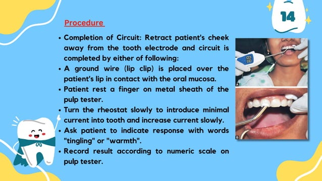 Pulpal diagnostic methods used in Dentistry | PDF | Dental Health ...