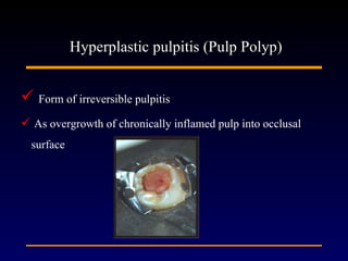Pulpal disease