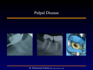 Pulpal disease
