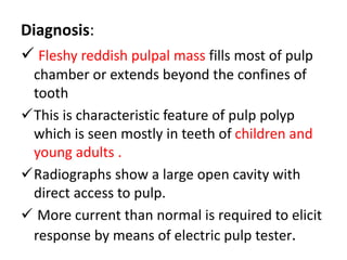 Pulpal diseases | PPTX