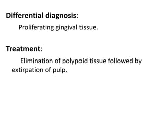 Pulpal diseases | PPTX
