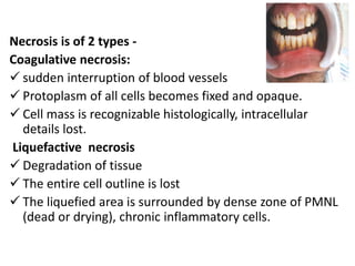 Symptoms:
Discoloration of teeth-Greyish or brownish discoloration.
No painful symptoms.
Partial necrosis responds to ther...