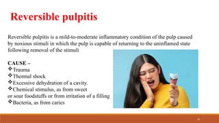 Shocking Pulp PULPAL DISEASES commonly seen in daily practice | PPTX