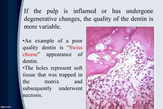 • If the pulp is inflamed or has undergone
degenerative changes, the quality of the dentin is
more variable.
•An example of a poor
quality dentin is “Swiss
cheese” appearance of
dentin.
•The holes represent soft
tissue that was trapped in
the matrix and
subsequently underwent
necrosis.
 