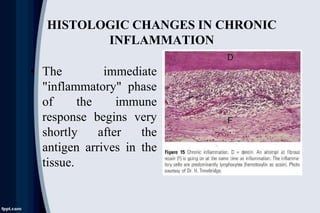 HISTOLOGIC CHANGES IN CHRONIC
INFLAMMATION
• The immediate
"inflammatory" phase
of the immune
response begins very
shortly after the
antigen arrives in the
tissue.
 